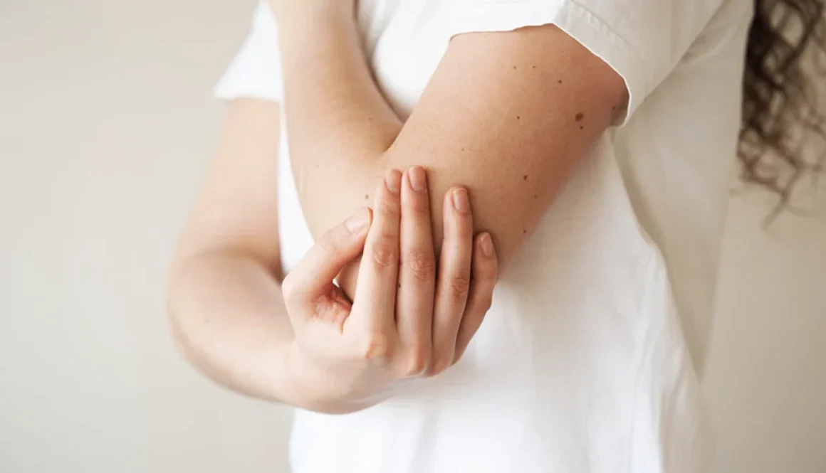 Łuszczyca a dieta – jak odpowiednie żywienie łagodzi objawy