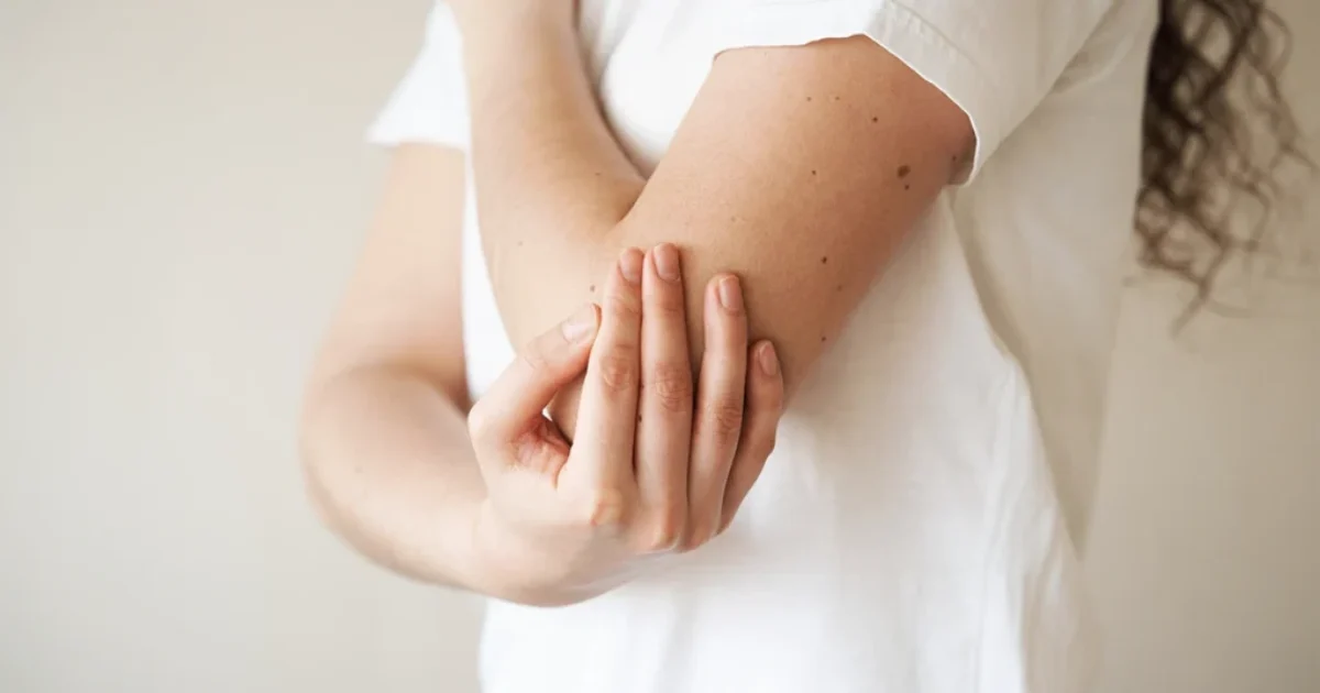 Łuszczyca a dieta – jak odpowiednie żywienie łagodzi objawy